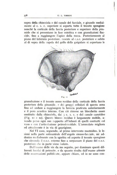 L'oto-rino-laringologia italiana