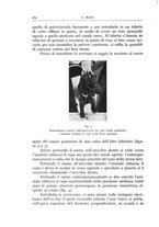 giornale/CFI0360651/1935/unico/00000448