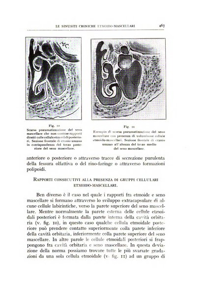 L'oto-rino-laringologia italiana