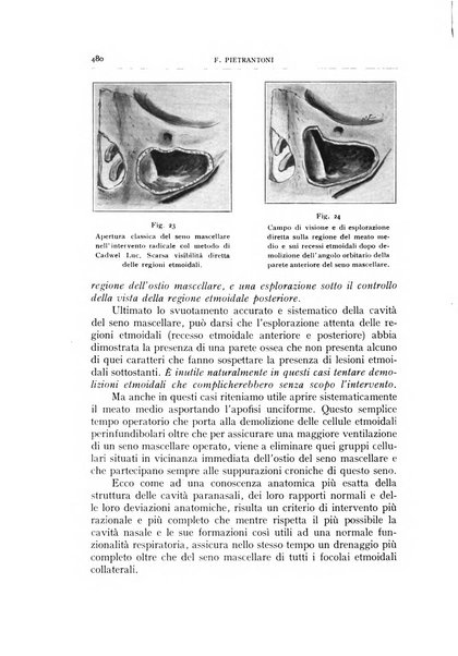 L'oto-rino-laringologia italiana