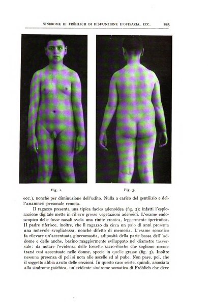 L'oto-rino-laringologia italiana