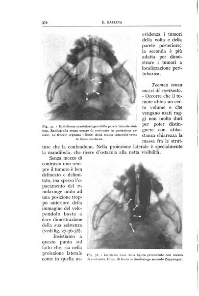 L'oto-rino-laringologia italiana