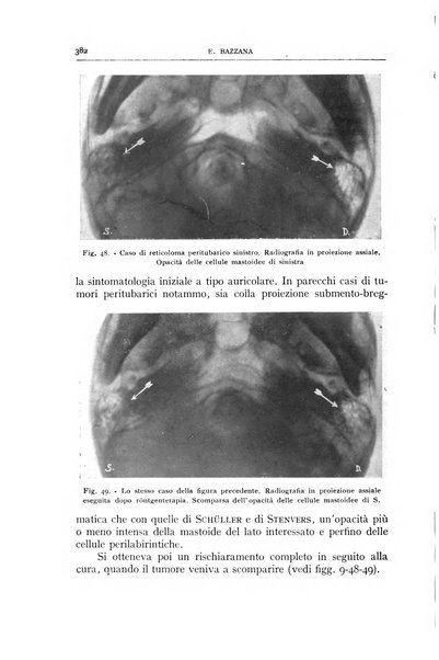 L'oto-rino-laringologia italiana