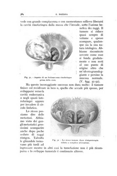 L'oto-rino-laringologia italiana