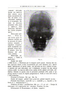 giornale/CFI0360651/1938/unico/00000157