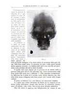 giornale/CFI0360651/1938/unico/00000159