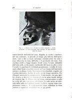 giornale/CFI0360651/1938/unico/00000434