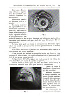 giornale/CFI0360651/1938/unico/00000465