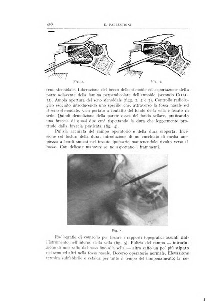 L'oto-rino-laringologia italiana