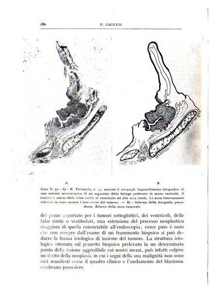 L'oto-rino-laringologia italiana