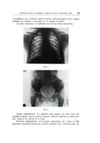 giornale/CFI0360651/1941/unico/00000201