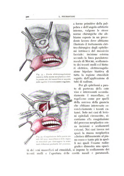 L'oto-rino-laringologia italiana