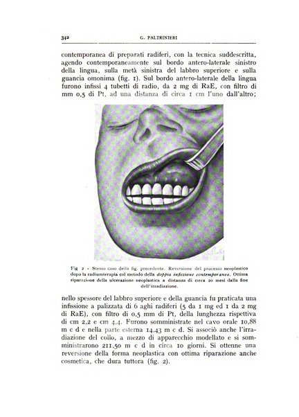 L'oto-rino-laringologia italiana