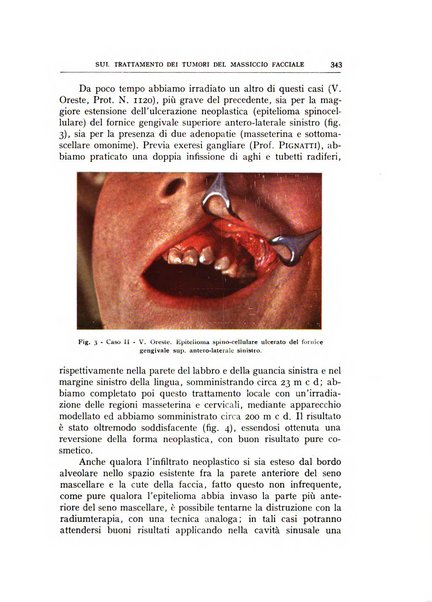 L'oto-rino-laringologia italiana