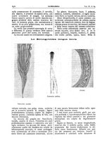 giornale/CFI0361052/1912/unico/00000290