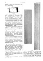 giornale/CFI0361052/1913/unico/00000720