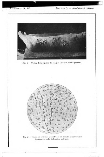 Pathologica rivista quindicinale