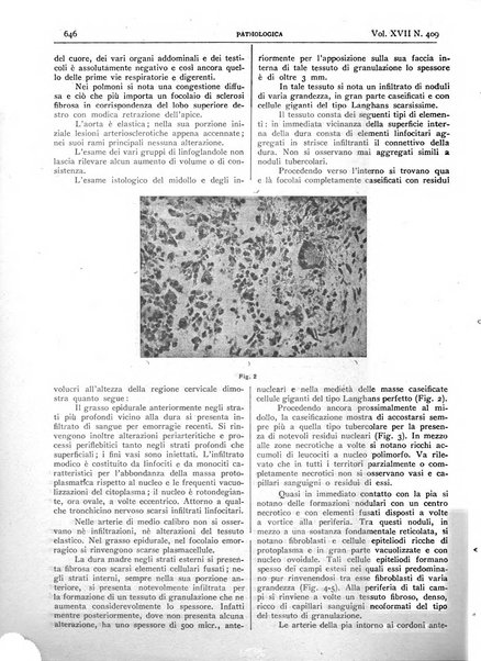 Pathologica rivista quindicinale