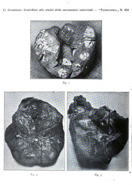 Pathologica rivista quindicinale