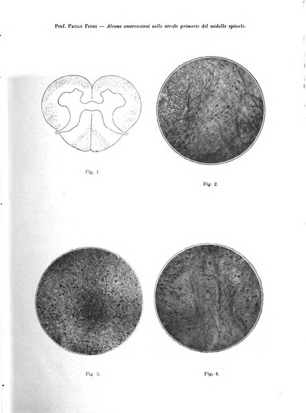 Pathologica rivista quindicinale