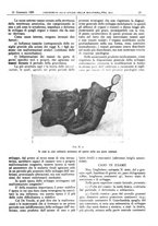 giornale/CFI0361052/1929/unico/00000071