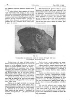 giornale/CFI0361052/1929/unico/00000072