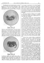 giornale/CFI0361052/1929/unico/00000119