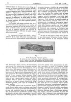 giornale/CFI0361052/1929/unico/00000120