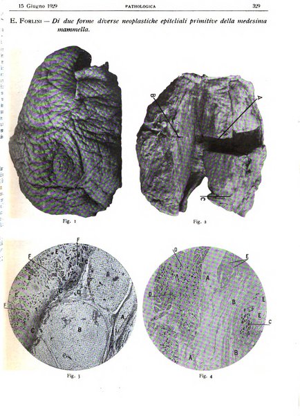 Pathologica rivista quindicinale