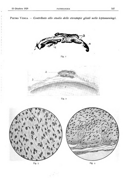 Pathologica rivista quindicinale