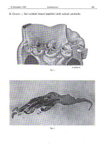 Pathologica rivista quindicinale