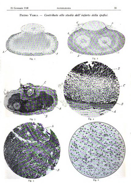 Pathologica rivista quindicinale