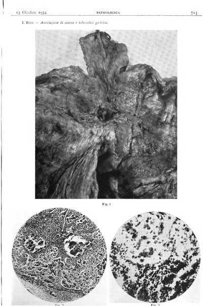 Pathologica rivista quindicinale