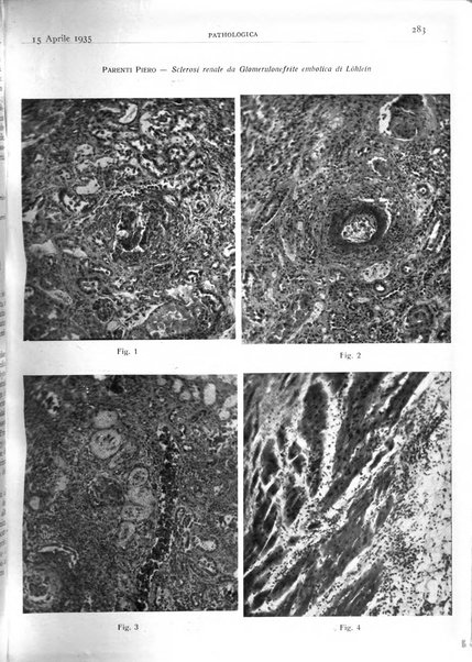 Pathologica rivista quindicinale