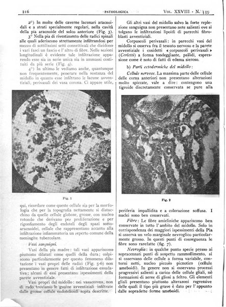 Pathologica rivista quindicinale