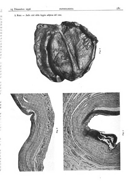 Pathologica rivista quindicinale