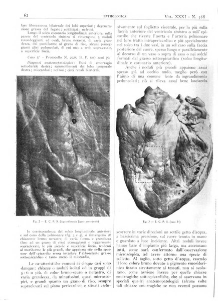 Pathologica rivista quindicinale