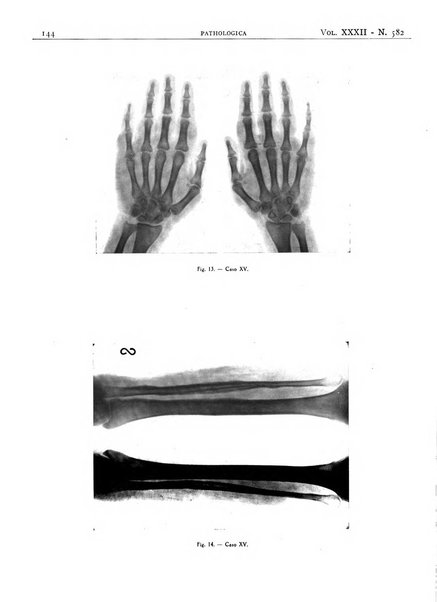 Pathologica rivista quindicinale