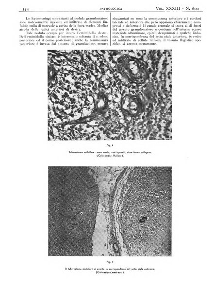 Pathologica rivista quindicinale