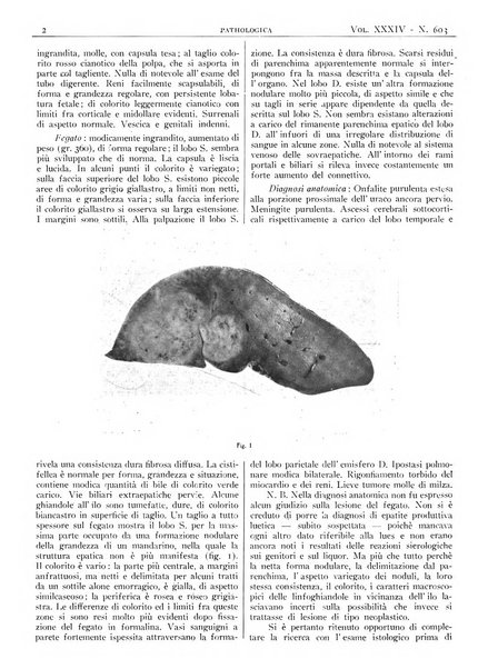 Pathologica rivista quindicinale