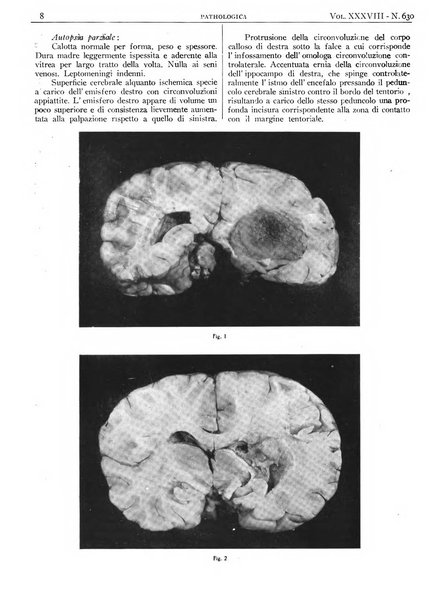 Pathologica rivista quindicinale