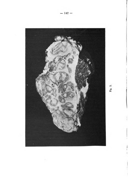 Patologia comparata della tubercolosi