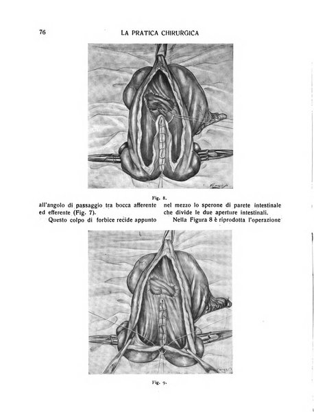 La pratica chirurgica e delle discipline affini Rivista bimensile