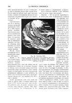 giornale/CFI0362084/1930/unico/00000374