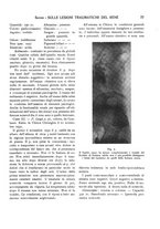 giornale/CFI0362084/1933-1936/unico/00000091