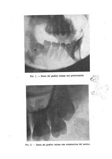 I quaderni dell'allergia rivista medica bimestrale