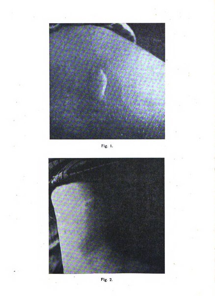 I quaderni dell'allergia rivista medica bimestrale