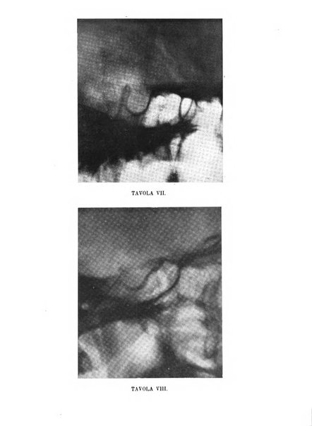 Quaderni di psichiatria rivista mensile teorica e pratica