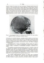 giornale/CFI0363168/1940/unico/00000014