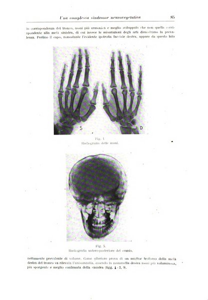 Rassegna di neurologia vegetativa